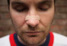 Uprooting Nasal Allergies from its root Nasal Allergies