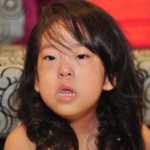 pompe disease child