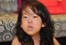 pompe disease child