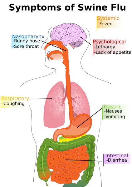 swin flu symptoms