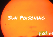 Sun-Poisoning