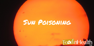 Sun-Poisoning