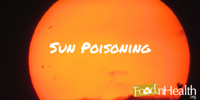 Sun-Poisoning