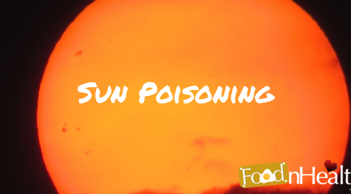 Sun Poisoning Sun-Poisoning