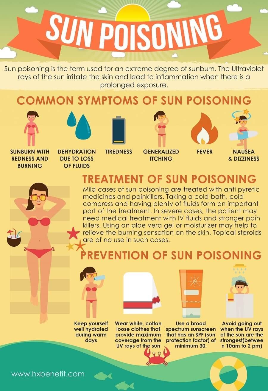 Do I have sun poisoning? Things you need to know