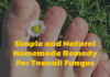 Simple and Natural Homemade Remedy For Toenail Fungus Homemade Remedy For Toenail Fungus