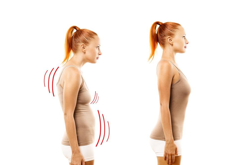 How to Finally Fix Your Posture and Avoid Back Pain