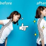 Posture Correction