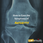 How to Ease the Symptoms of Arthritis How to Ease the Symptoms of Arthritis