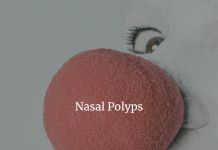 Nasal polyps - Symptoms and causes