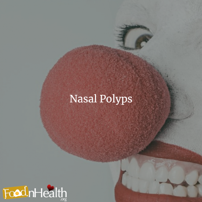 Nasal polyps - Symptoms and causes