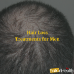 Hair Loss Treatments for Men