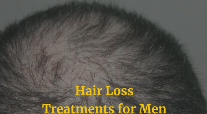 Hair Loss Treatments for Men