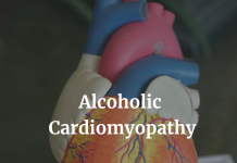Alcoholic Cardiomyopathy: Causes, Symptoms, and Diagnosis Alcoholic cardiomyopathy is a type of acquired dilated cardiomyopathy associated with long-term heavy alcohol consumption (commonly defined as >80 g per day over a period of at least five years)