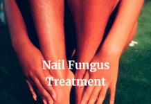 Toenail Fungus Treatment: Steps to Get Rid of It Fast!