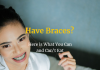 Have Braces? Here is What You Can and Can’t Eat
