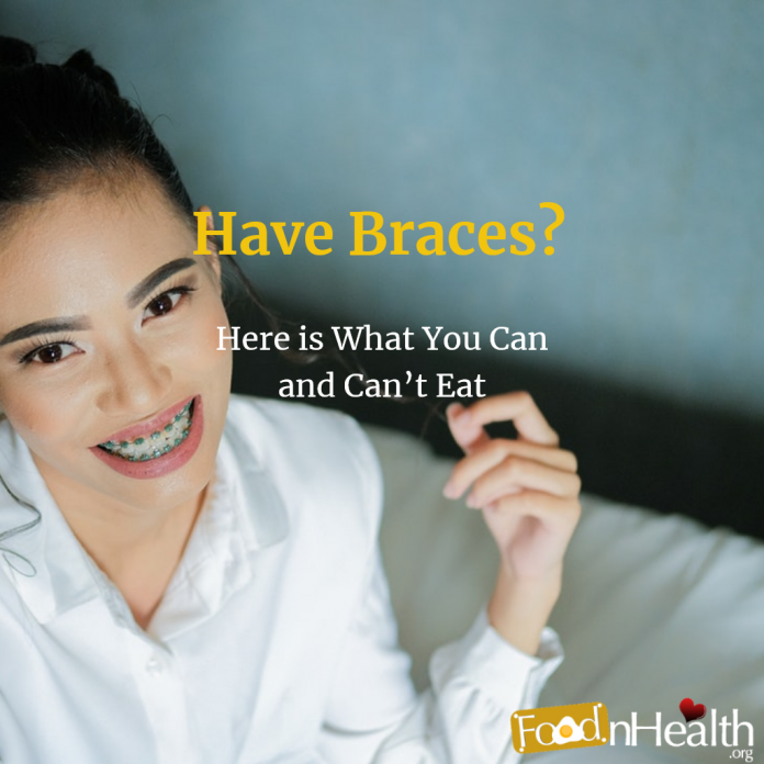Have Braces? Here is What You Can and Can’t Eat