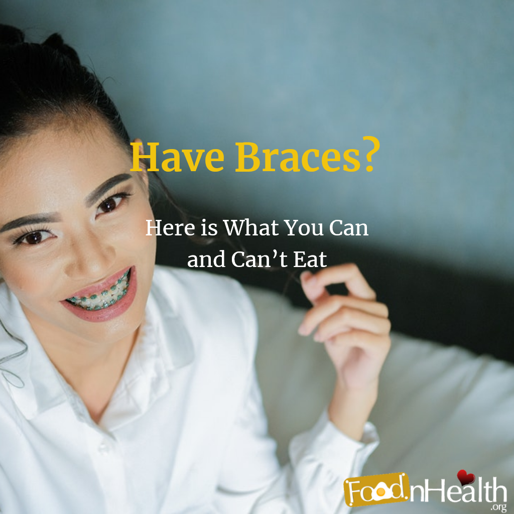 Have Braces Here Is What You Can And Cant Eat Food N Health 