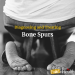 Diagnosing and Treating Bone Spurs Diagnosing and Treating Bone Spurs