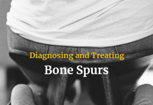 Diagnosing and Treating Bone Spurs Diagnosing and Treating Bone Spurs