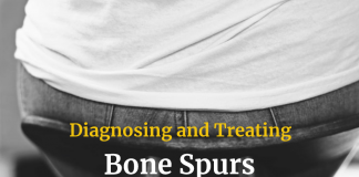 Diagnosing and Treating Bone Spurs
