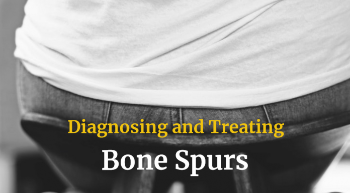 Diagnosing and Treating Bone Spurs Diagnosing and Treating Bone Spurs