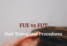 Hair Transplant Procedures – FUE vs FUT Hair Transplant Procedures - FUE vs FUT