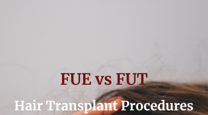 Hair Transplant Procedures - FUE vs FUT