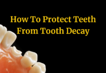 Cavities and Tooth Decay: Symptoms, Causes and Treatment
