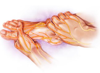 Ayurvedic Management of Diabetic foot