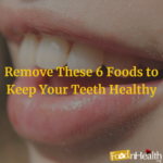 Remove These 6 Foods to Keep Your Teeth Healthy Remove These 6 Foods to Keep Your Teeth Healthy