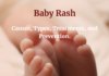 Baby Rash: Causes, Types, Treatments, and Prevention.