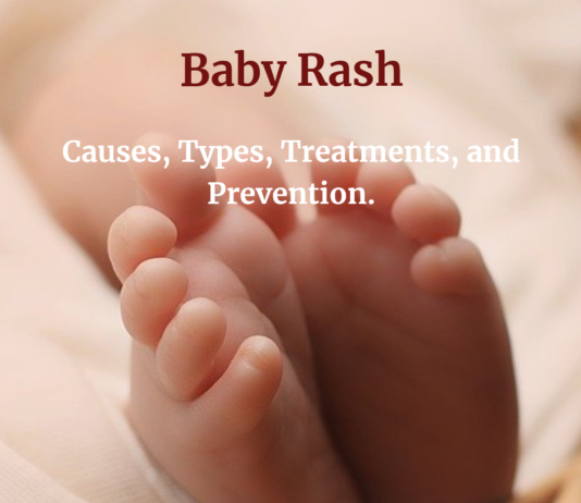 Baby Rash: Causes, Types, Treatments, and Prevention.
