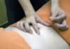Seven Reasons Why You Should Get Acupuncture