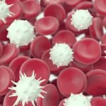 White Blood Cell Disorders: Symptoms & Causes White Blood Cell