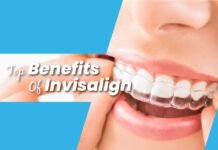 Top Benefits of Invisalign For Misaligned Teeth Top Benefits-of-Invisalign