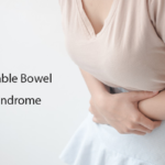 Irritable Bowel Syndrome