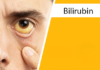 Bilirubin