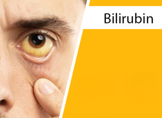 Bilirubin