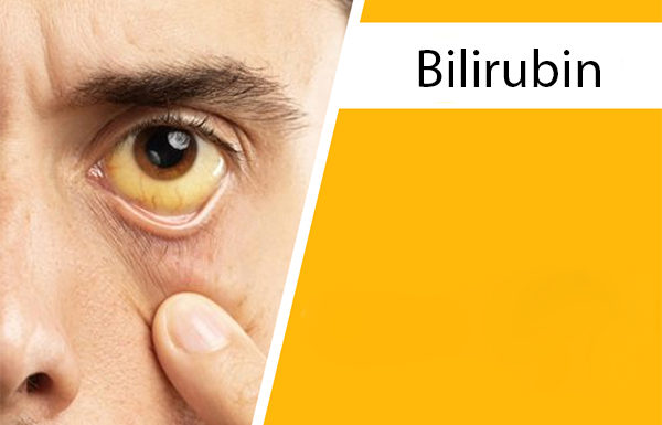 Bilirubin