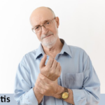 Arthritis