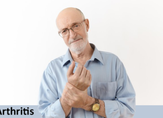 Arthritis