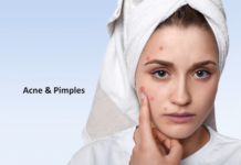 Ayurvedic Tips to Get Rid of Acne and Pimples Acne and Pimples
