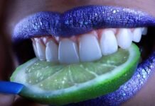 9 Tips To Improve Discolored Teeth Improve Discolored Teeth