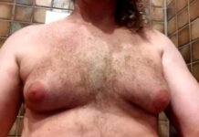 Things Men Need to Know Before Having Gynecomastia Surgery