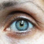 Eyelift