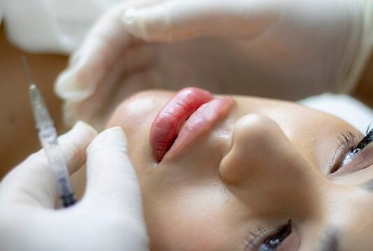 Lip Filler