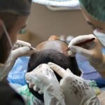 Medical Conditions That a Hair Transplant Can Help
