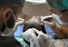 Medical Conditions That a Hair Transplant Can Help