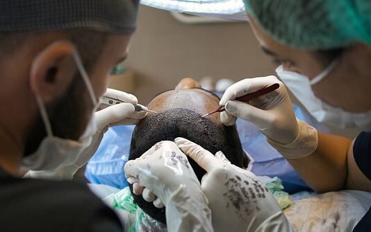 Medical Conditions That a Hair Transplant Can Help
